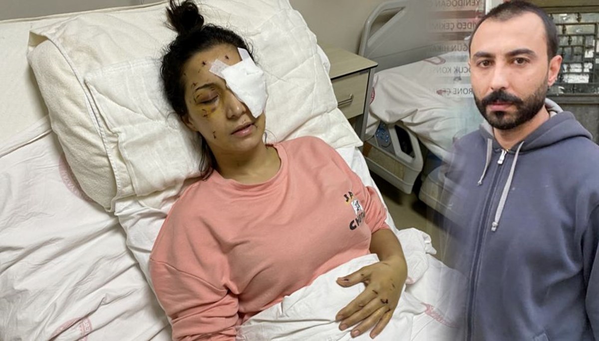 'Ağabey' demeyen yengesini 37 yerinden bıçaklayıp kör etti