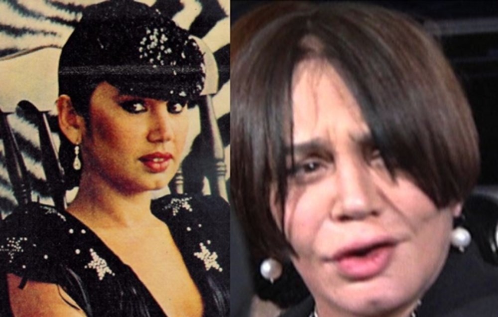 Peker Açıkalın'dan yeni imaj: Son hali şaşırttı (Ünlülerin değişimi) - 201