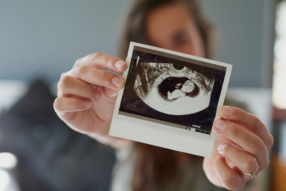 Anne adaylarına uyarı: Hamilelik öncesinde alkol tüketimi bebeklerin yüzünün değişmesine neden oluyor - 9