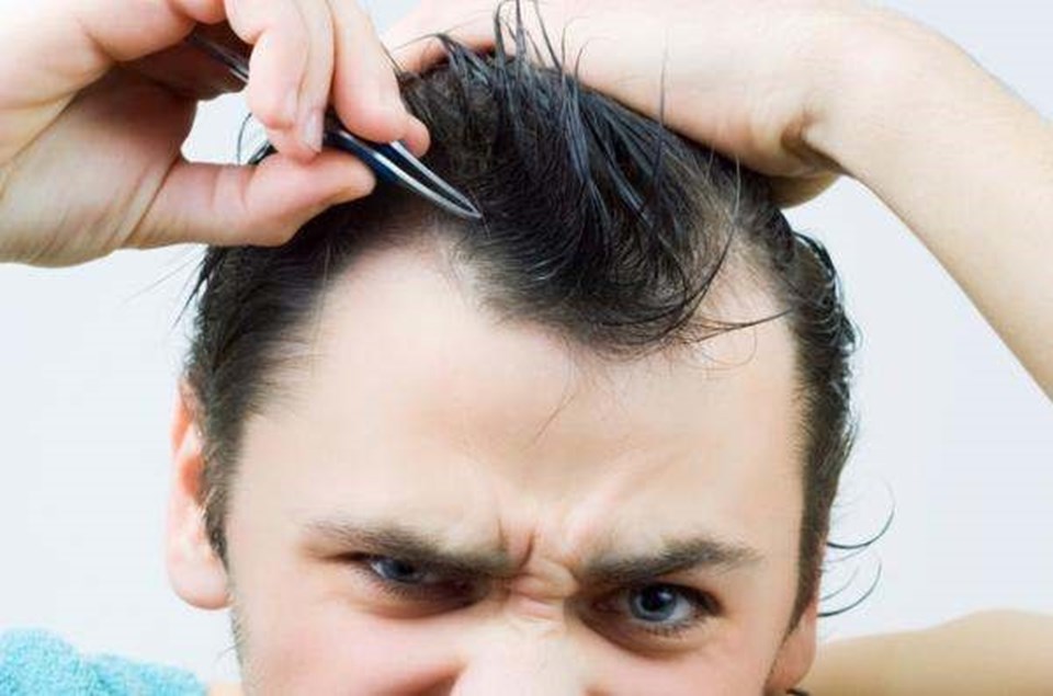 “Saç koparma tedavi edilebilir bir hastalıktır” (Trikotilomani nedir?) - 1