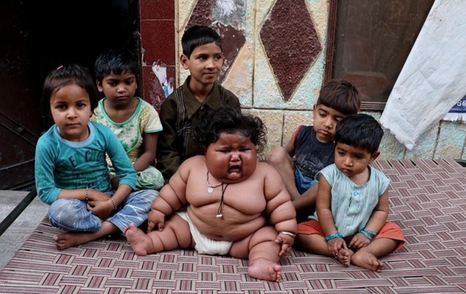 Görenler şaşırıyor, 8 aylık Chahat Kumar bebek 17 kilo! - 5