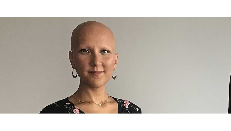 “Saçkıran hastaları, perukla saklanmak zorunda değil" (Alopesi Derniği kuruldu)