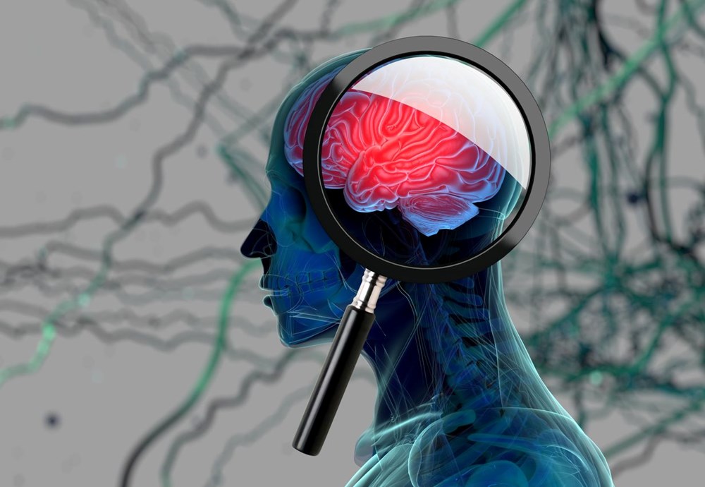Alzheimer için umut veren keşif: İlk belirtiler gözlerde ortaya çıkıyor - 3