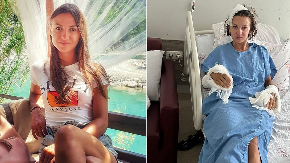 Antalya'da koca dehşeti iddiası: Evine girerken sopalı saldırıya uğradı - 1