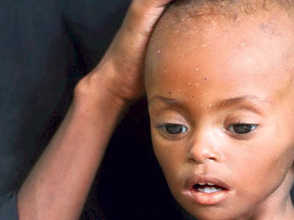 diyaliz hastalarinda intihar egilimi