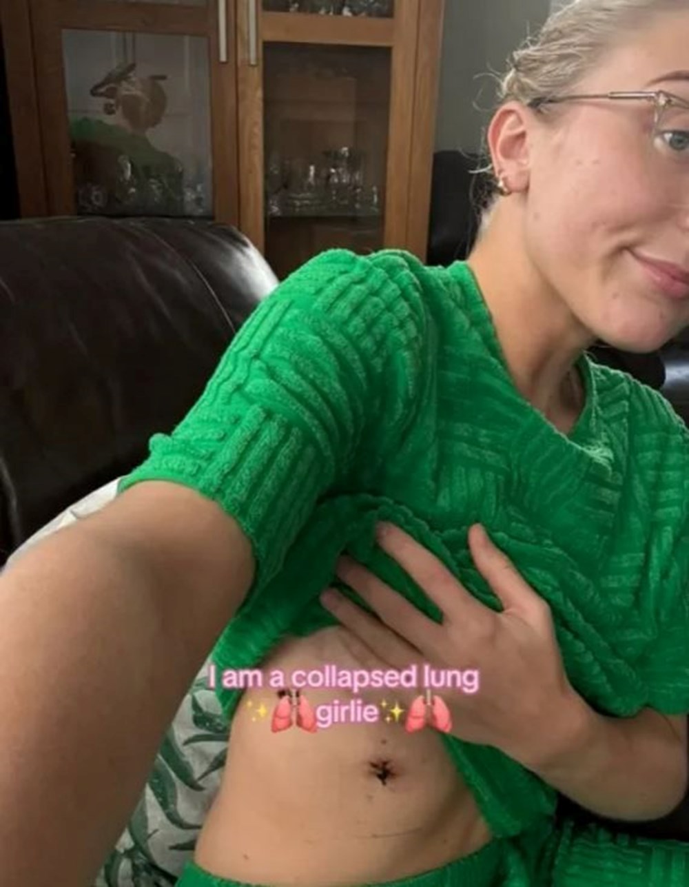 Akciğer sönmesinin 4 işareti: 23 yaşındaki teşhisli hasta anlattı - 5