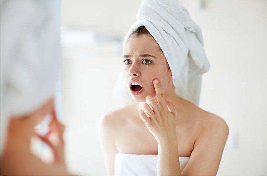 sivilce yapan yiyecekler