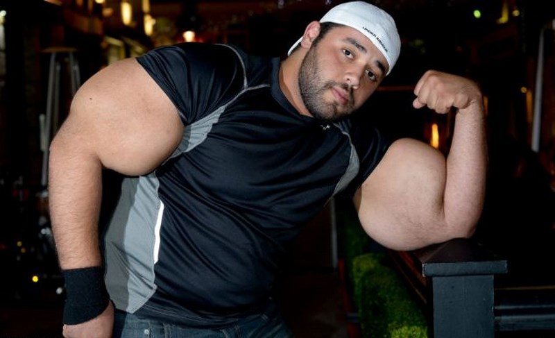 Synthol Man Dies