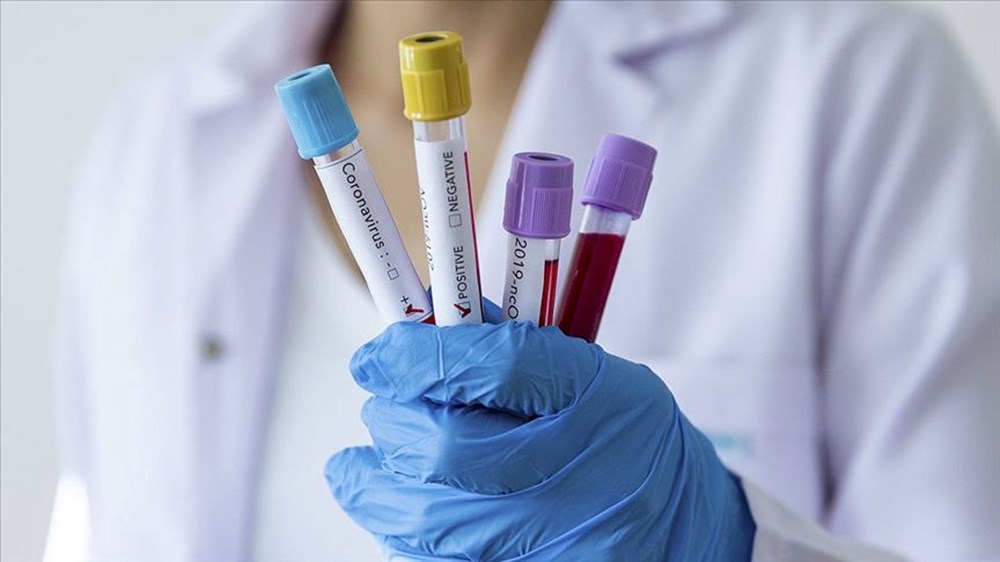 Covid-19'da yeni varyant alarmı: ERİS varyantının salgın riski var mı? Etkisi ne kadar olabilir? - 4