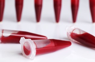 nadir hastaliklar zamaninda tedavi