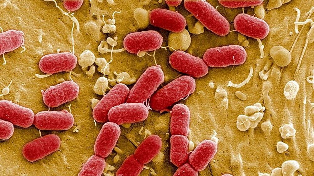 DSÖ'den süper bakteri uyarısı: Süper bakteri nedir, bulaşıcı mı, Türkiye'de görüldü mü? - 8