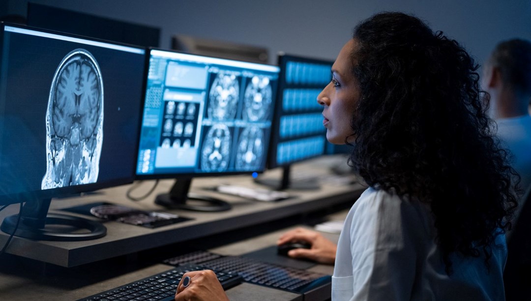 Araştırma: Şizofreni hastalarının beyinleri daha hızlı yaşlanabilir