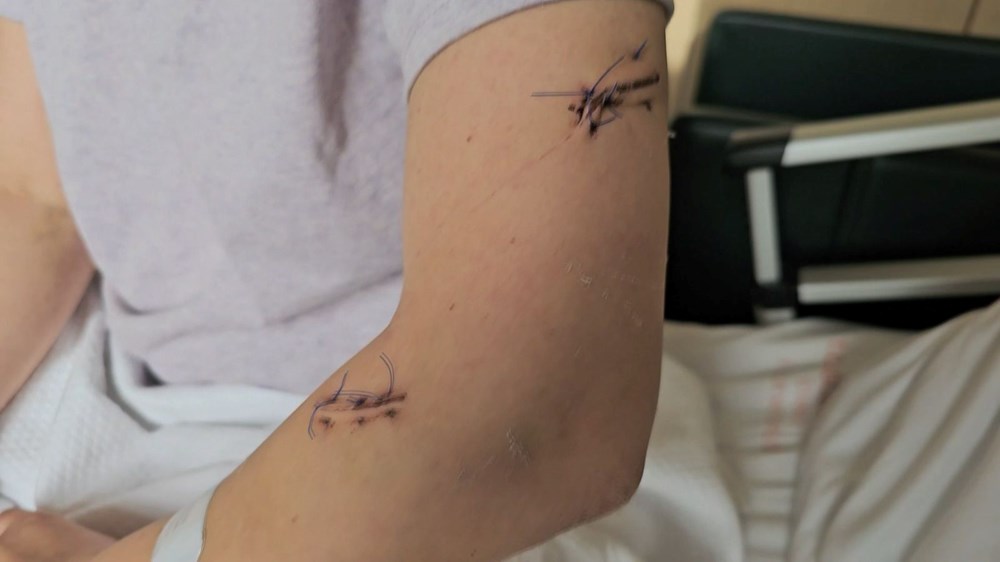 Defalarca bıçakladı, ölmesi için başında bekledi! Mucize kadın yaşadığı dehşeti anlattı - 5