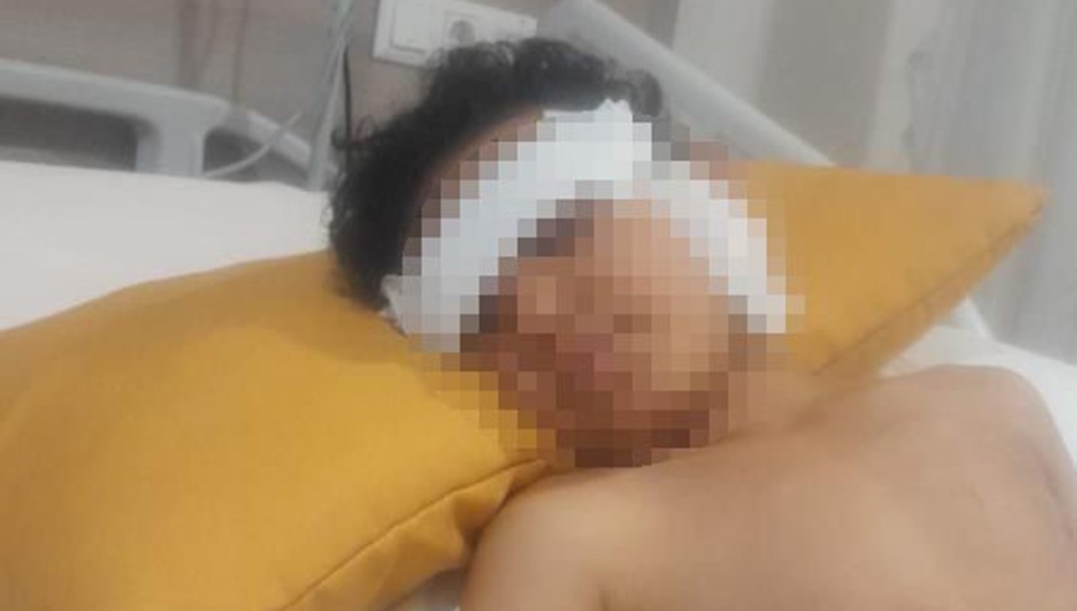 Ankara'da 5 yaşındaki çocuğa köpek saldırısı Ankara'da 5 yaşındaki çocuğa köpek saldırısı