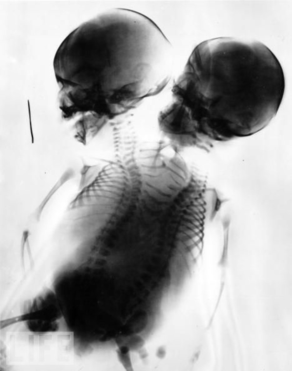 Hayatın röntgeni NTV Hayatın röntgeni NTV