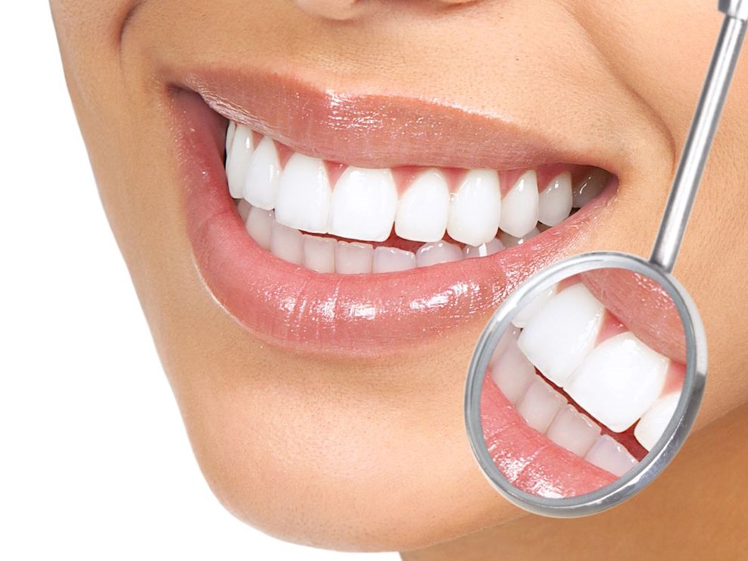 Kanal Tedavisinde Dogru Bilinen Yanlislar Dikkat Dis Kaybina Yol Acabilir Saglik Haberleri Ntv