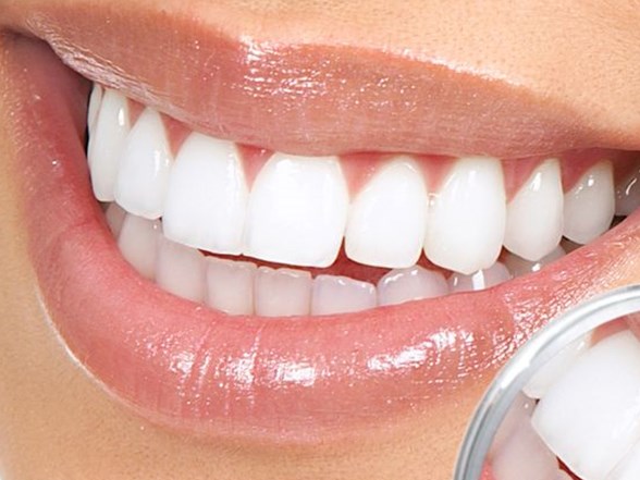 kanal tedavisinde dogru bilinen