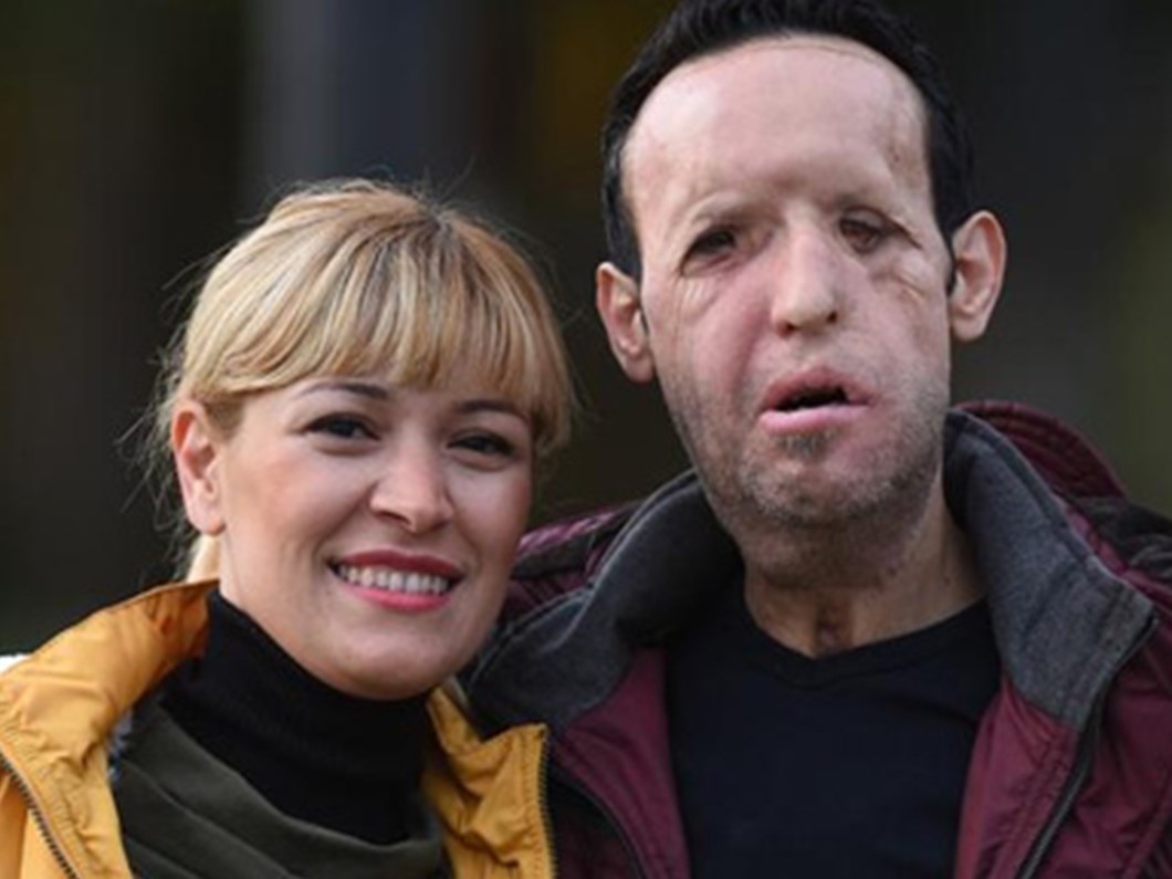 yuz nakli yapilan recep sert tutuklandi ntv