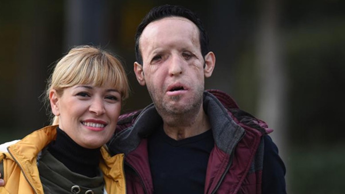 yuz nakli yapilan recep sert tutuklandi ntv