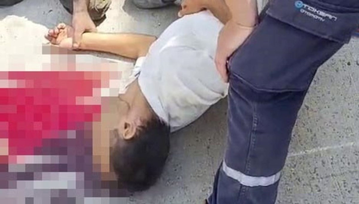 Başı damper kapağına sıkıştı Başı damper kapağına sıkıştı