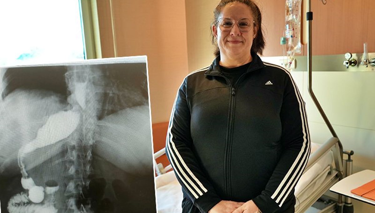 100 binde bir görülüyor: Zayıflamak için masaya attı, doktorları gördükleri karşısında şoke oldu 100 binde bir görülüyor: Zayıflamak için masaya attı, doktorları gördükleri karşısında şoke oldu