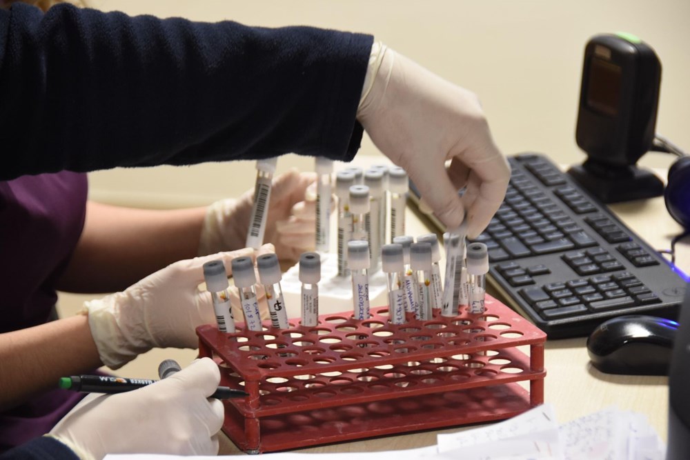 Mutated corona virus cases are detected in 40 minutes - 2