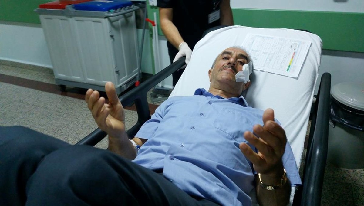 Maganda kurşunuyla yanağından vuruldu Maganda kurşunuyla yanağından vuruldu