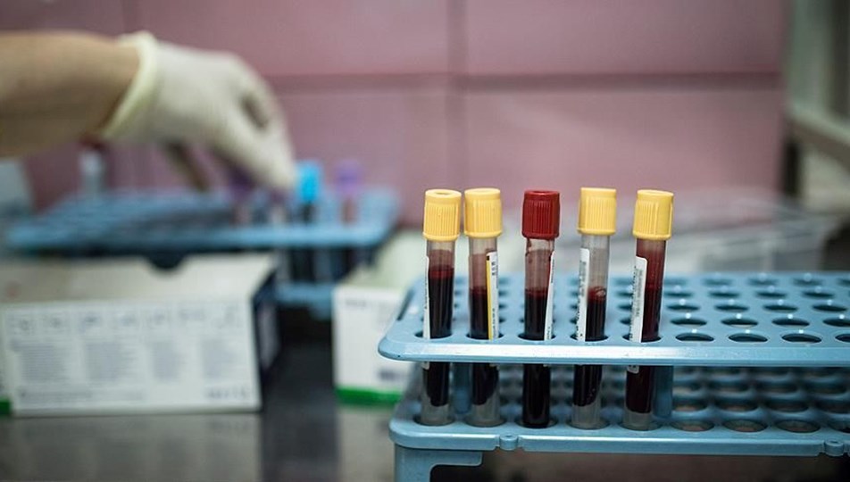Kanser teşhisinde devrim: Kan testiyle her üç kanserden ikisi tespit edildi