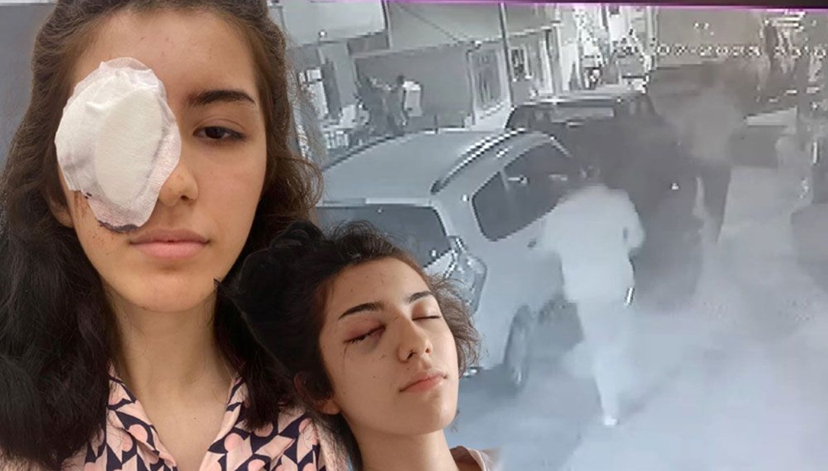 Maganda kurşunu 16 yaşındaki kızı kör etti