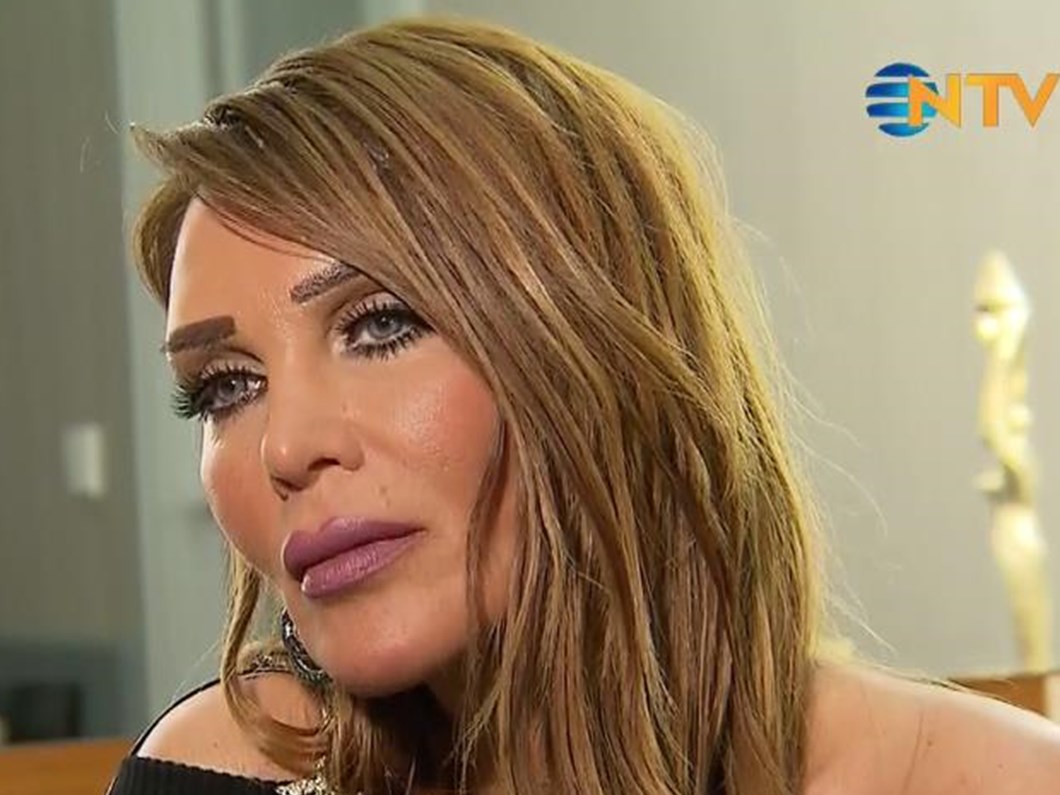 Seren Serengil Den Estetik Aciklamasi Magazin Haberleri Ntv Seren Serengil Den Estetik Aciklamasi Magazin Haberleri Ntv