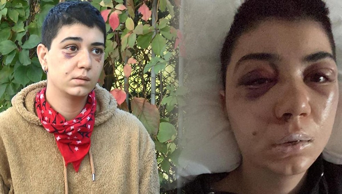 Beyoğlu'nda kadına felç eden dayak