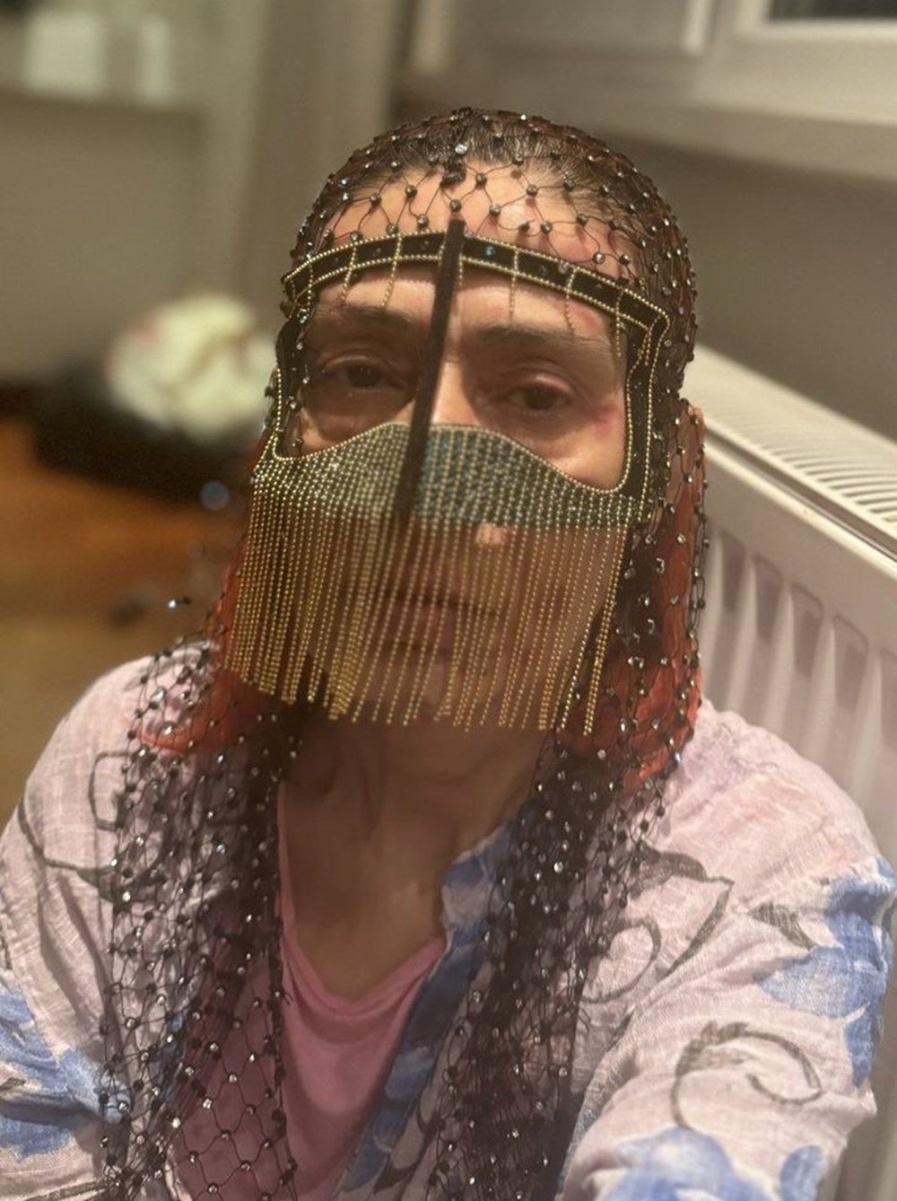 Yıldız Tilbe yüzündeki renkli beneklerle konser verdi - 2