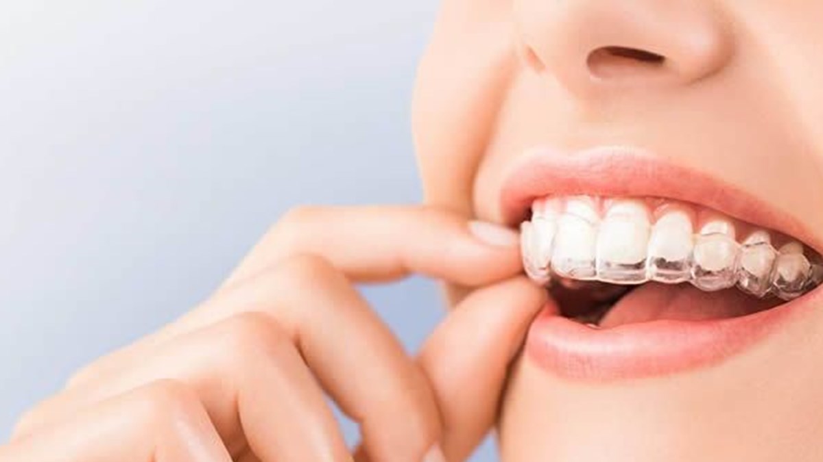 Dijital Ortodonti Ile Hata Riski Minimuma Iniyor Saglik Haberleri Ntv