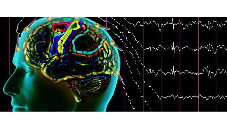 Epilepsinin kesin nedeni bilinmiyor (Epilepsiyi neler tetikler?)