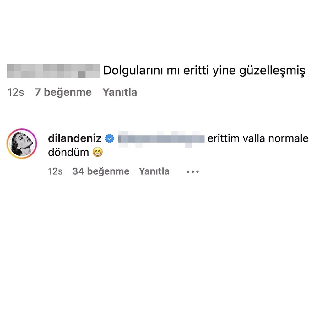Dolgularını mı eritti? Dilan Çiçek Deniz'den takipçisine yanıt - 6
