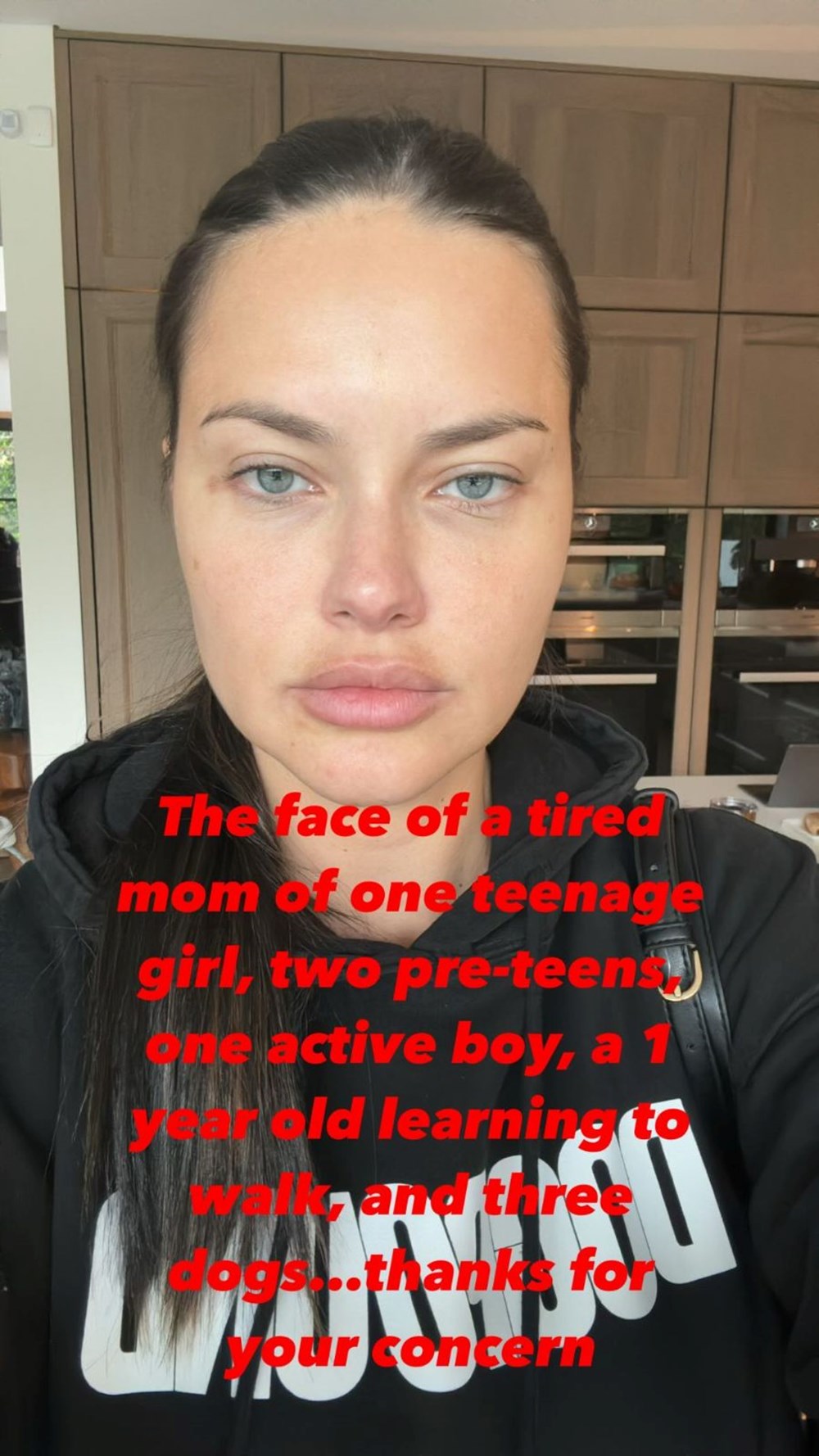 Yüzündeki değişimle şaşırtan Adriana Lima sessizliğini bozdu - 5