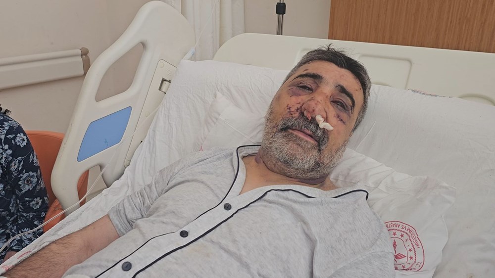 İngiliz boksörün komalık ettiği taksici yoğun bakımdan çıktı, yaşananları anlattı: Öptü, ısırdı, elini gözüme soktu - 6