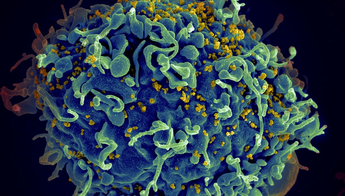HIV tedavisinde çığır açacak adım