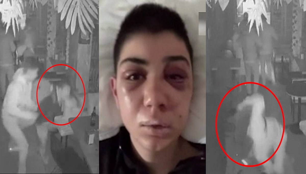 Genç kızı felç eden dayak kamerada