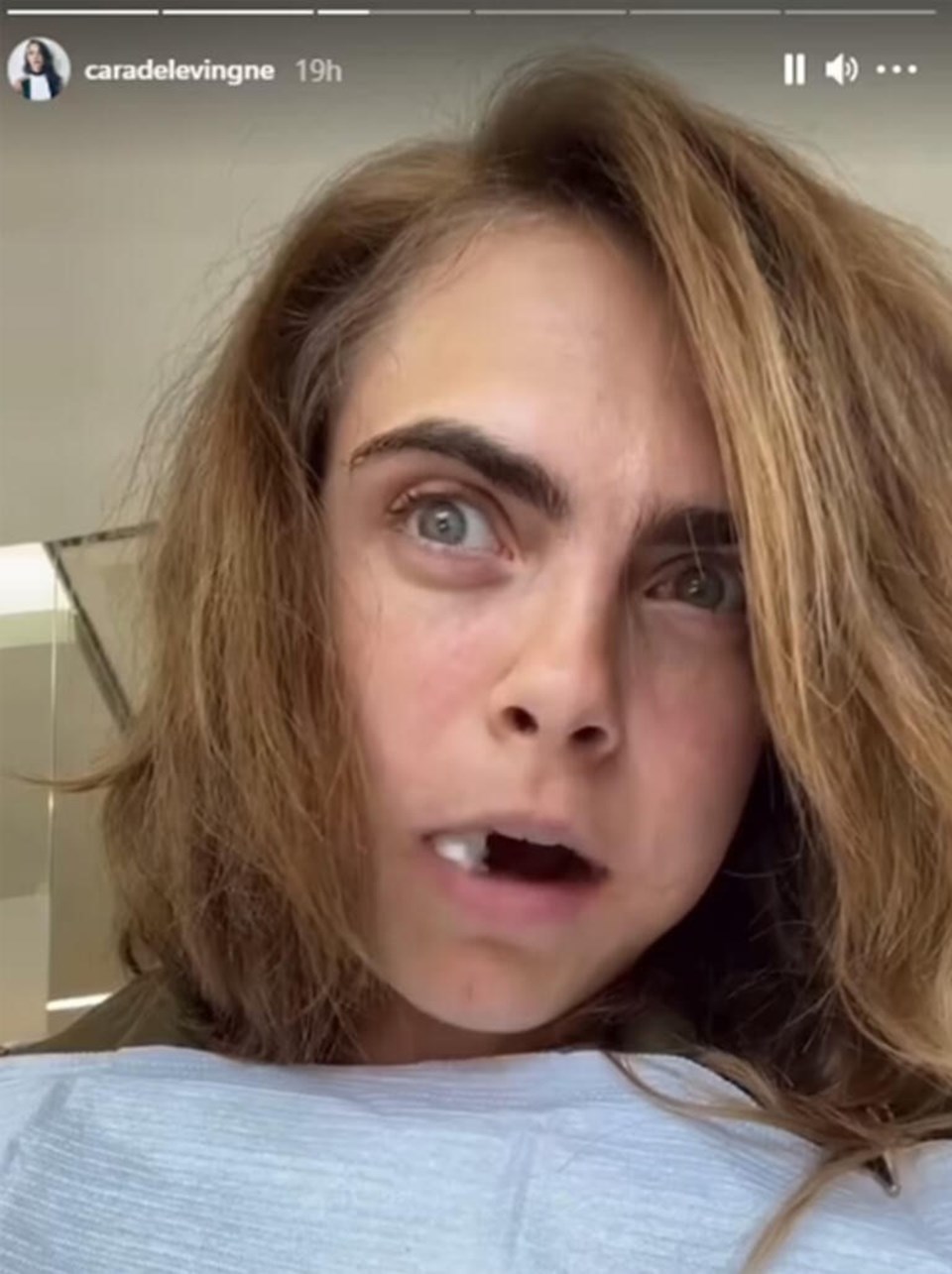 Cara Delevingne dişçi koltuğundan paylaştı: Çok ağladım - 2