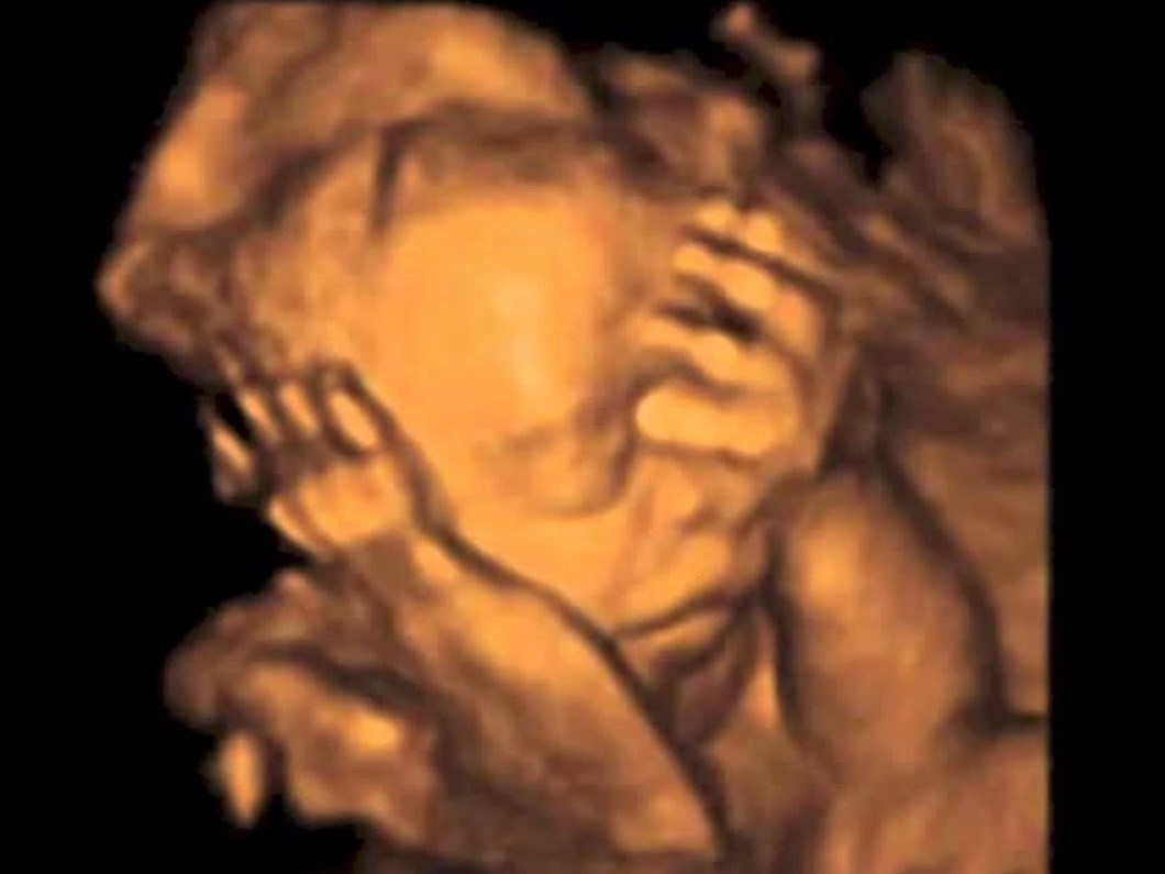 anne karninda 20 dakika saglik haberleri ntv