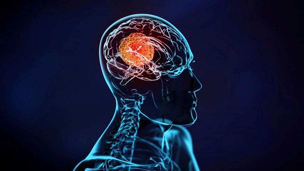 Erkek ve kadın beyni birbirinden farklı mı çalışıyor? Yaygın inanış çürütüldü - 2