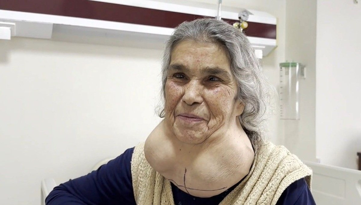 Doktor korkusundan 50 yıl böyle yaşadı! Doktor korkusundan 50 yıl böyle yaşadı!