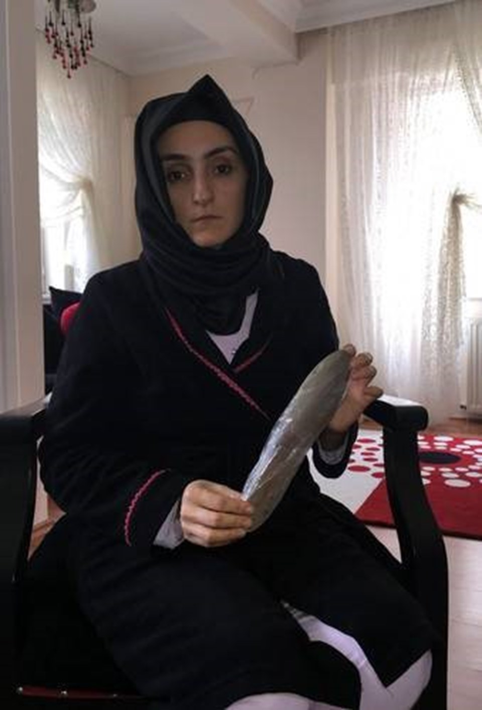 Fatma Soylu, doktorların karnında unuttuğu 30 cm'lik malayı gösterdi.