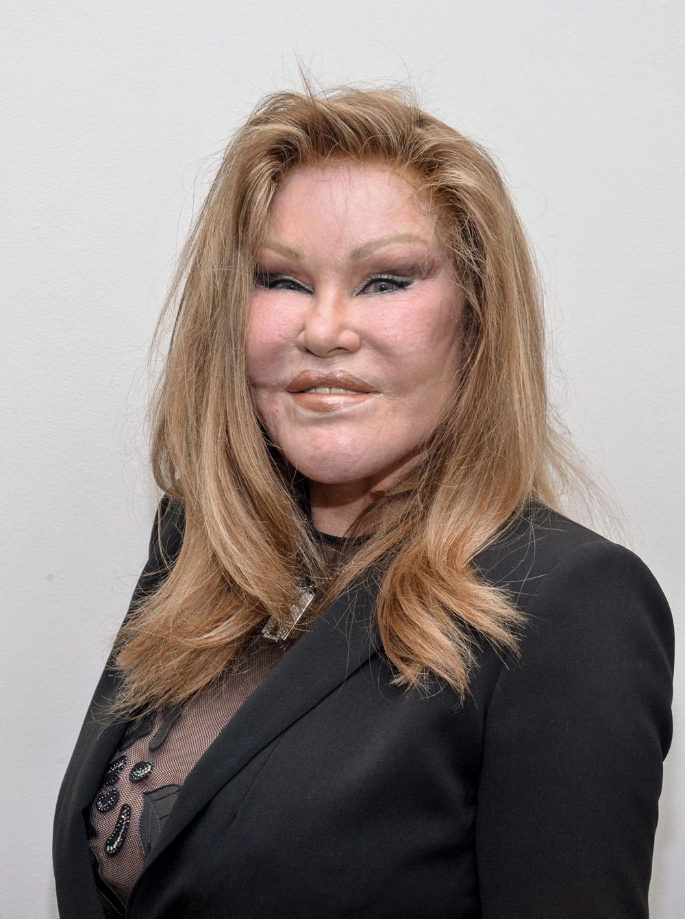 "Kedi Kadın" Jocelyn Wildenstein yaşamını yitirdi: Estetik bağımlılığıyla tanınıyordu - 4