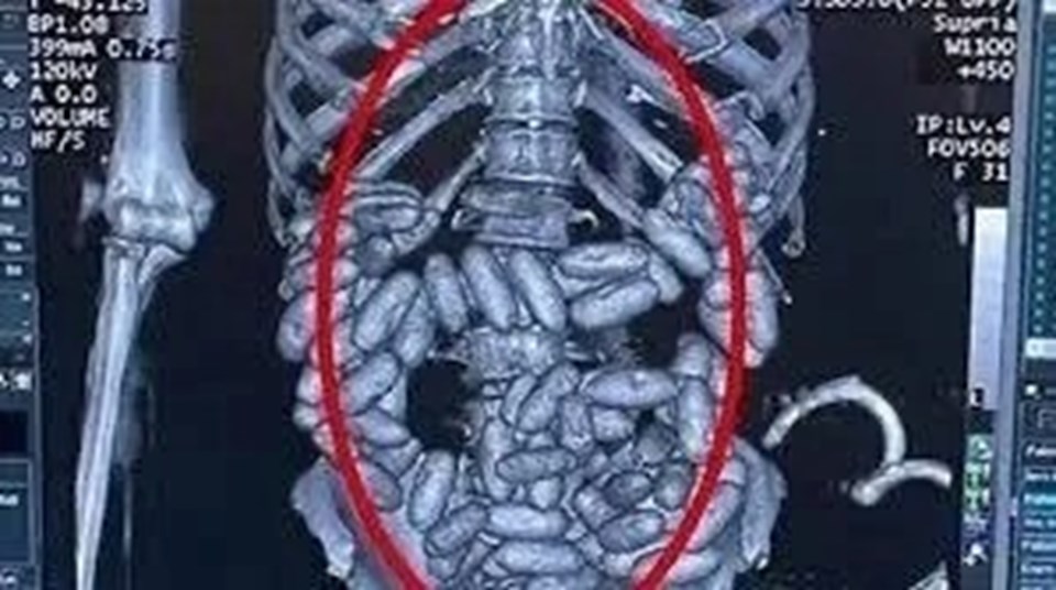 "Yutucu kuryeler" ile dünyayı zehirledi: Türk uyuşturucu baronu teslim oldu - 1