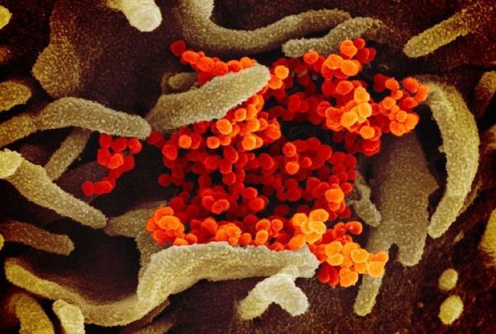 Corona virüsün (Covid-19) fotoğrafları yayınlandı Corona virüsün (Covid-19) fotoğrafları yayınlandı