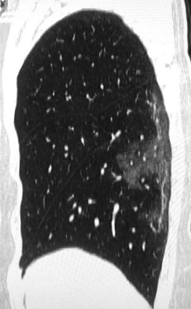 44 yasinda corona virusten hayatini