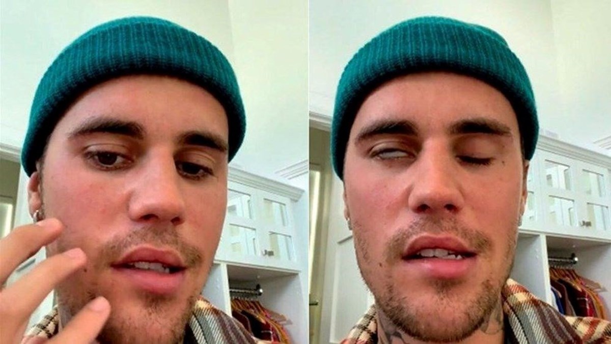 Justin Bieber rahatsızlığı nedeniyle dünya turnesini gelecek seneye erteledi - 2