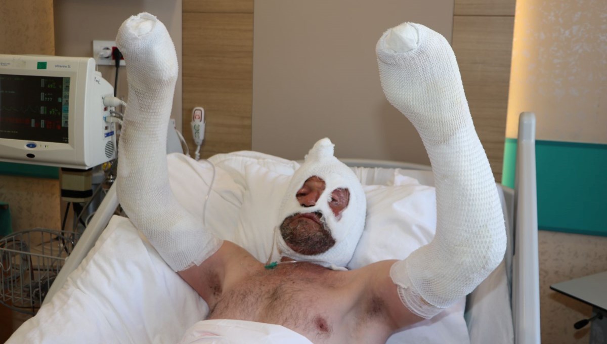 Benzin bidonu sonu oluyordu: “Olayın etkisinden kurtulamıyorum, rüyama giriyor” Benzin bidonu sonu oluyordu: “Olayın etkisinden kurtulamıyorum, rüyama giriyor”
